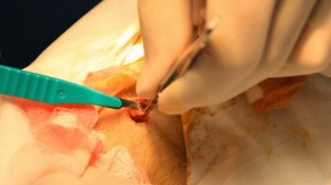 cutting-the-implant